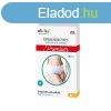 Akuku bugyi szls utni eldobhat PREMIUM 5db S