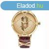 Ni karra Police ( 34 mm) MOST 184850 HELYETT 64827 Ft-rt