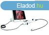 Fiberoszkp Flexibilis Laringszkp - Rhino laryngoscope VISI