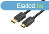 Vention Displayport 1.2 -> HDMI 1.4, 1,5m (fekete), kbel