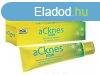 ESI aCknes gl - Akns brre, mint pattans, mitesszer, fe
