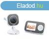 Beurer BY 110 Baba videotelefon