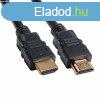 BLACKBIRD Kbel HDMI male/male sszekt 2K 1m, Fekete