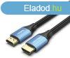 Vention HDMI/M -> HDMI/M (4K, HD, Alu, kk), 1,5m, kbel