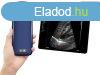 Kzi ultrahang "3in1" color doppler, lineris s k